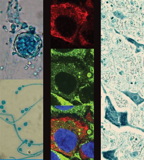 Serratia Infections: from Military Experiments to Current Practice.